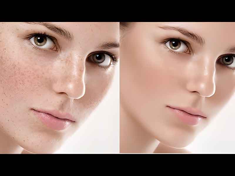 Retouch hình ảnh